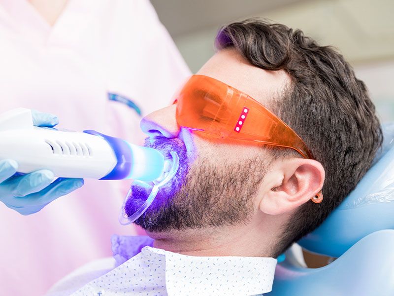 Teeth Whitening | Tijuana