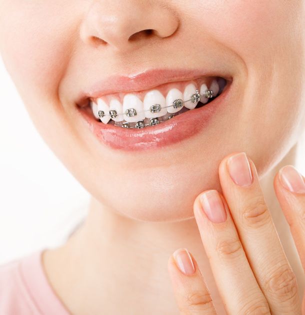 Orthodontic Tijuana