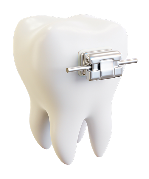Orthodontics | Tijuana